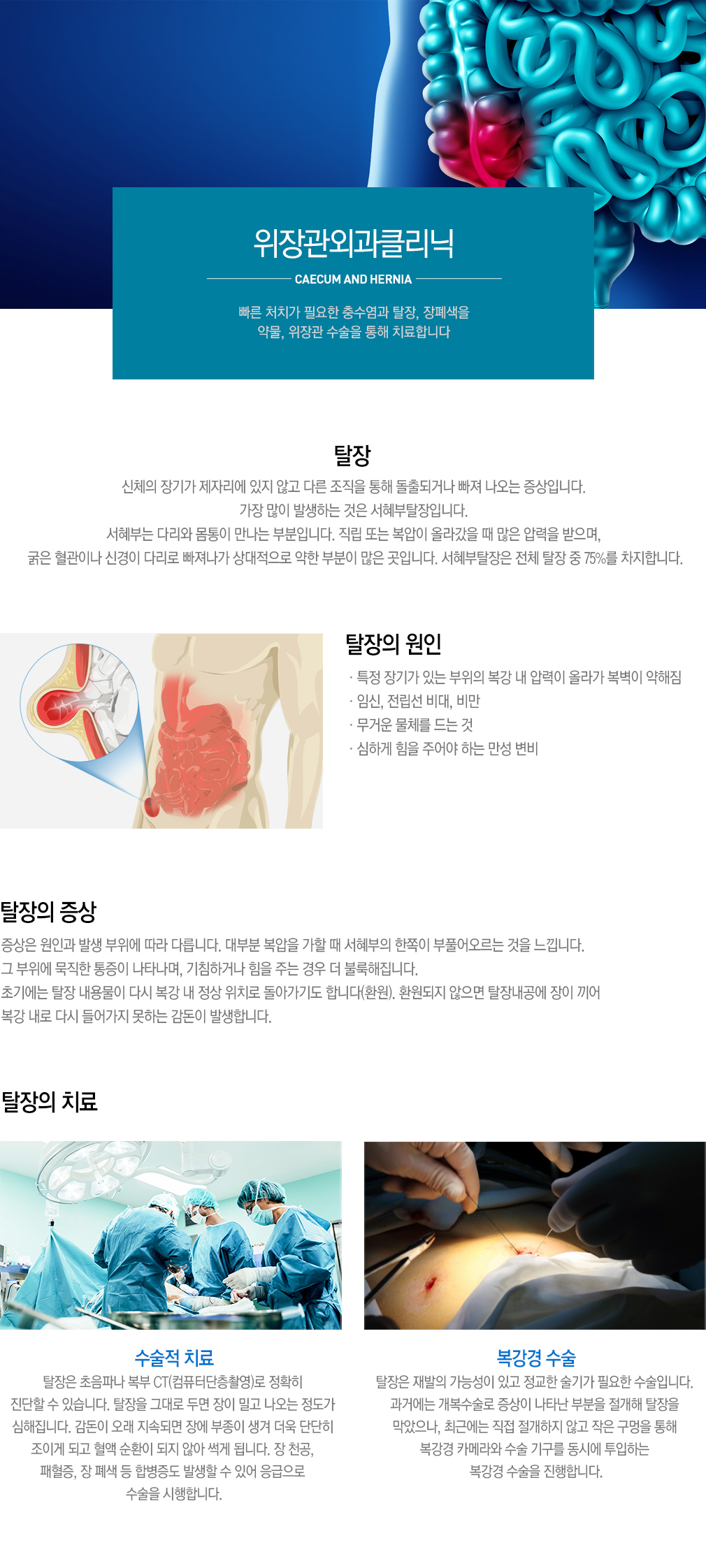 탈장클리닉