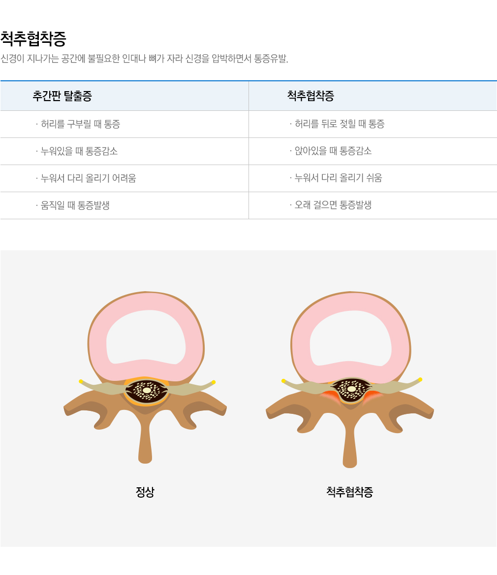 내시경 치료 가능한 척추질환