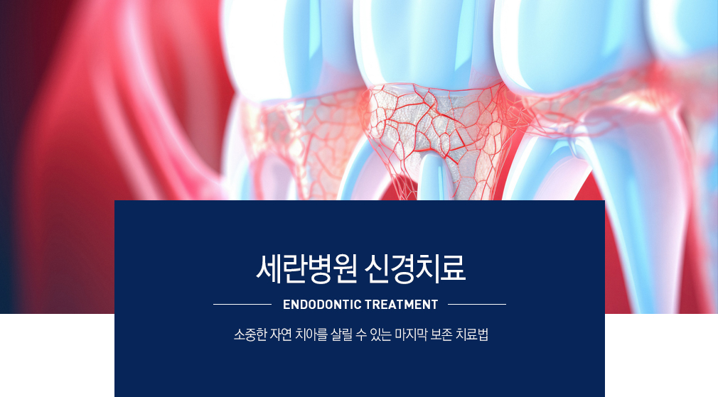 신경치료란
