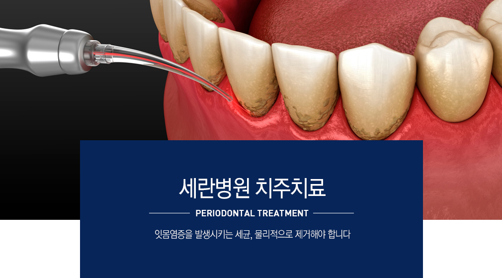 치주치료란