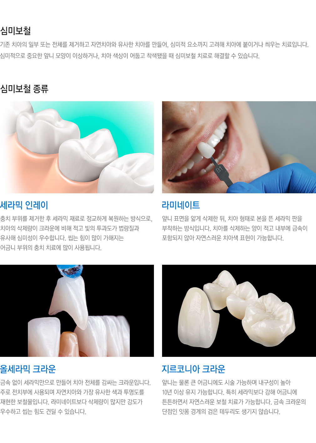 심미보철