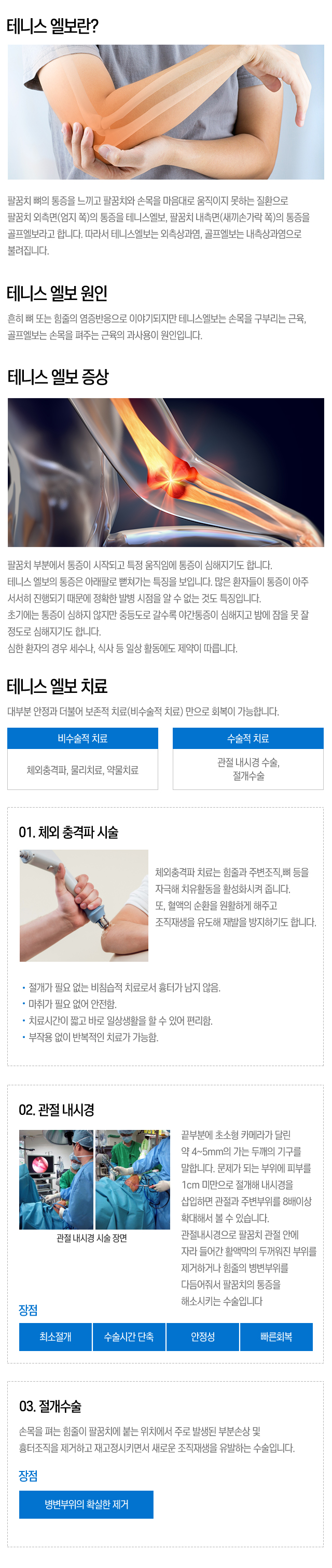 손목터널증후군