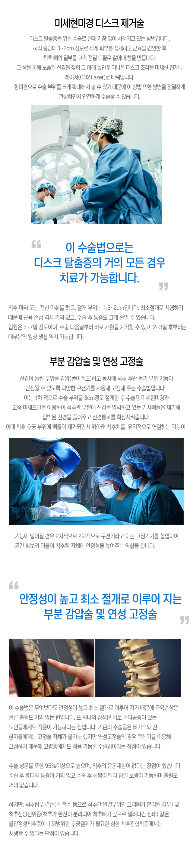 미세현미경 디스크 제거술