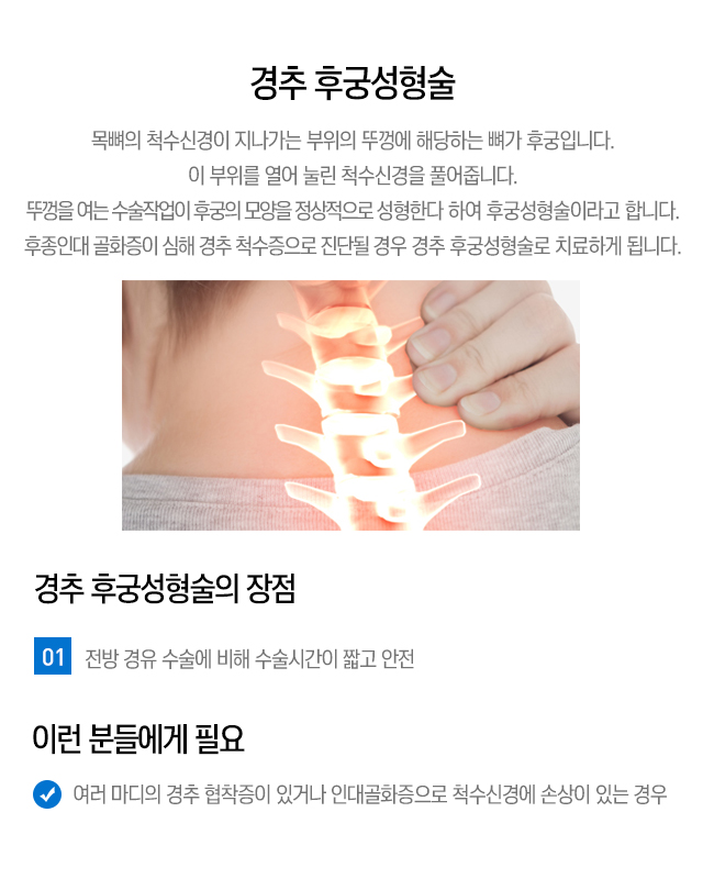 골시멘트와 풍선을 이용한 척추체 성형술