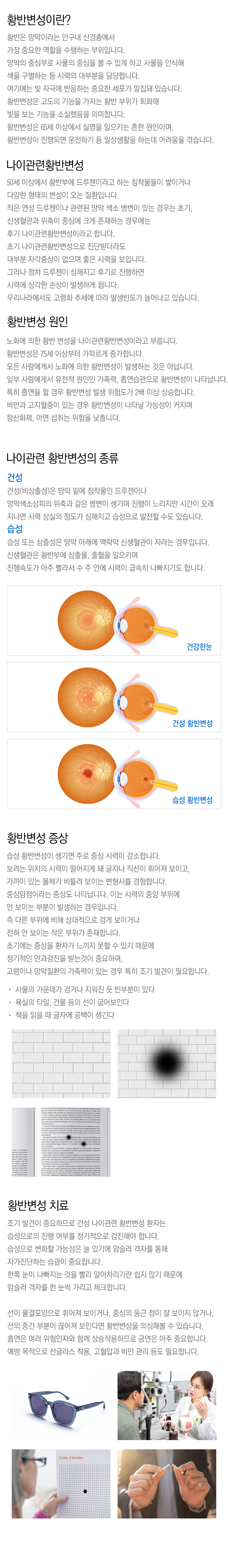 황반변성