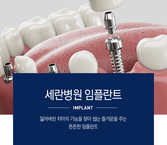 임플란트가 필요한 경우