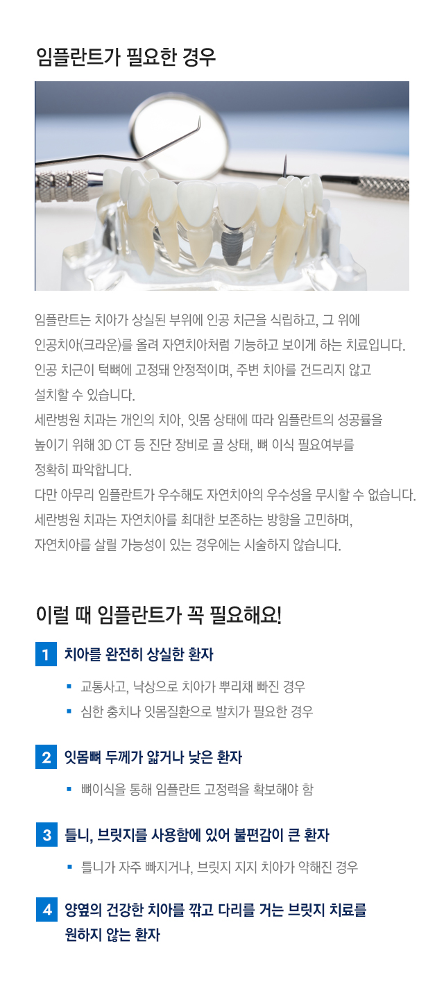 임플란트가 필요한 경우