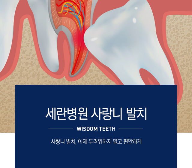 사랑니