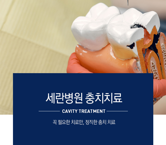 충치 종류