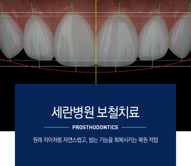 보철치료란
