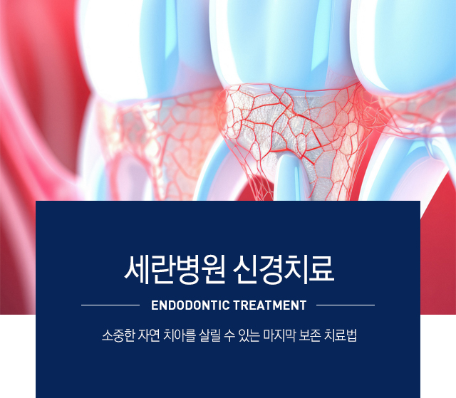 신경치료란