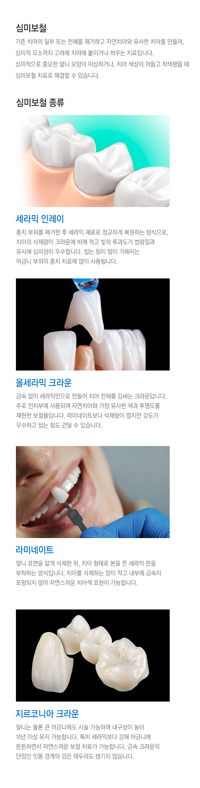 심미보철
