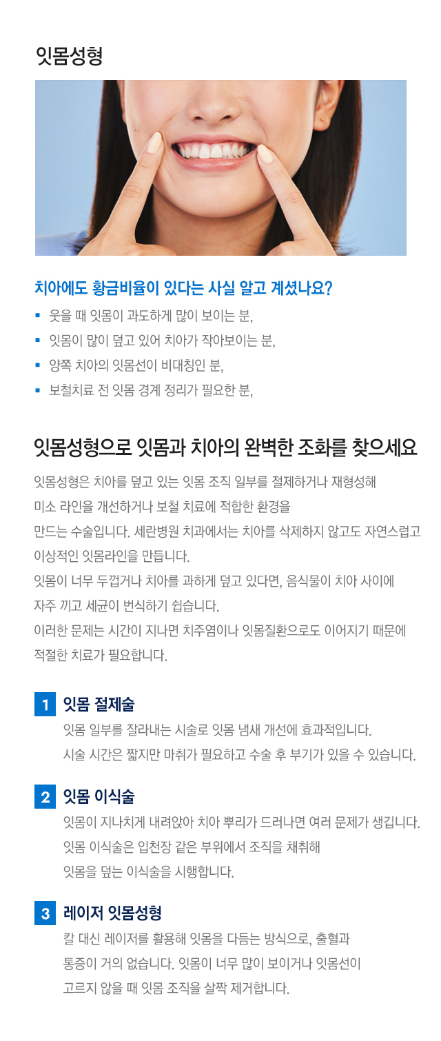 잇몸성형