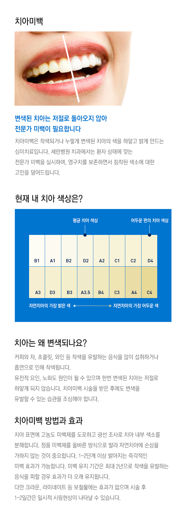 치아미백