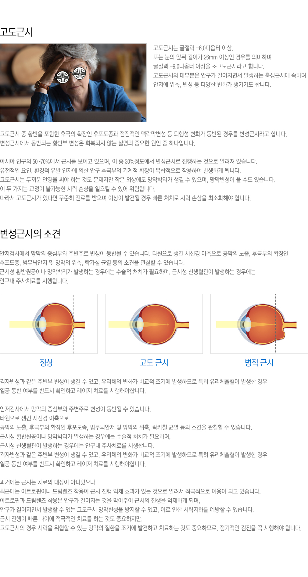 고도근시&변성근시·